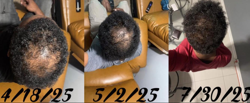 LIL Momma's Hair Growth (The Juice)